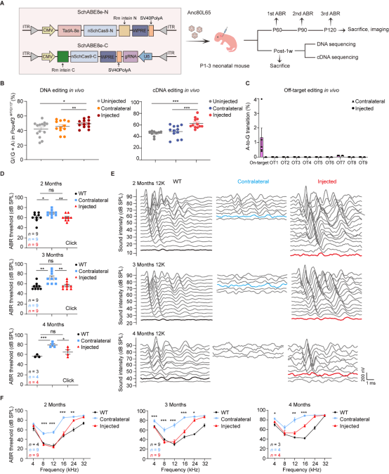 国际快讯 | 柴人杰教授团队耳聋领域最新研究成果在国际权威期刊发表